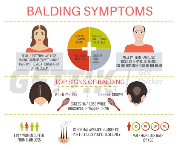 balding infographic 