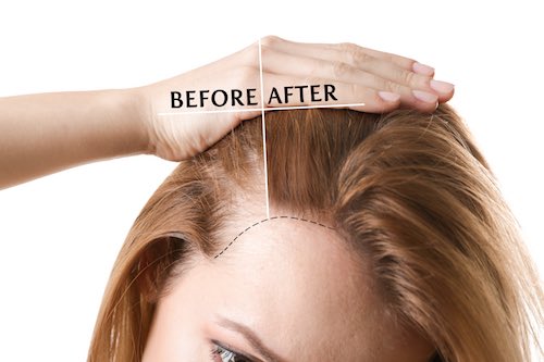 women hair growth products effects